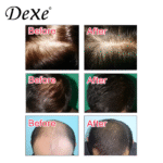 Dexe Anti-Hair Loss Shampoo